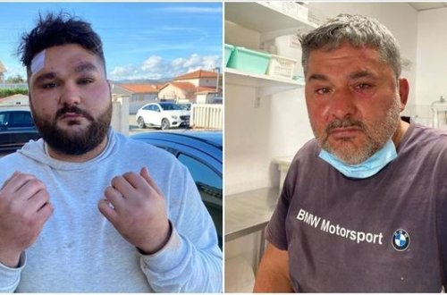 Ermənilərin Fransada hücum etdikləri türkiyəli: “Yaxınlıqda olan Fransa polisi müdaxilə etmədi” - FOTO