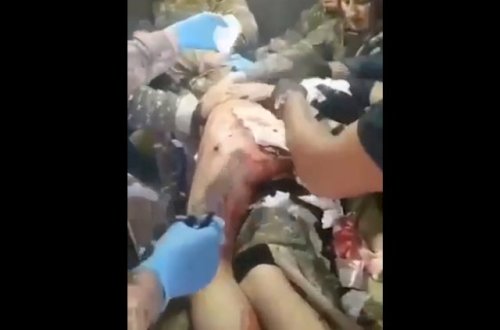 Araik Arutyunyanın hospitaldan görüntüləri yayıldı - Video