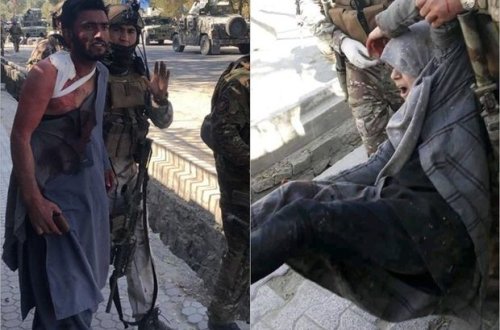 Kabildə universitetə silahlı basqın: Onlarla ölü və yaralı - FOTO/VİDEO