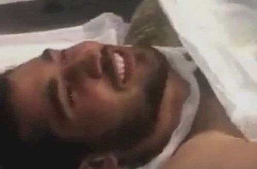 Yaralı əsgər əməliyyat masasında “Qarabağ” oxudu - Video