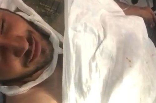 Раненый азербайджанский солдат спел песню о Карабахе - ВИДЕО