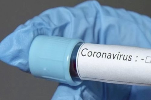 Rusiyada rekord sayda yoluxma - 256 nəfər öldü