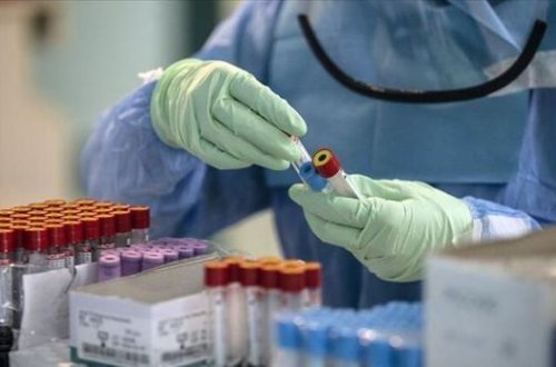 Koronavirusla bağlı SON STATİSTİKA