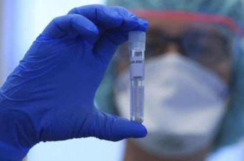 Азербайджан обновил рекорд по числу инфицированных и скончавшихся от COVID-19 - ФОТО