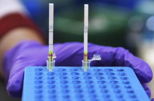 Koronavirusla bağlı SON STATİSTİKA