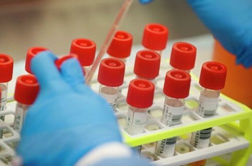 Азербайджан обновил рекорд по числу скончавшихся от COVID-19 - ФОТО