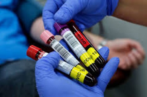 Koronavirusu 10 dəqiqəyə öldürən vasitə - Azərbaycanda bitir