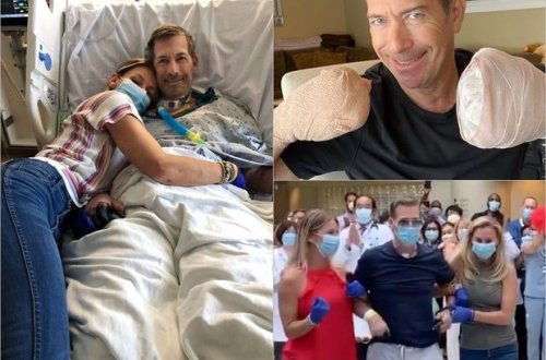 COVID-19-a yoluxan pasiyent xəstəlik üzündən səkkiz barmağını itirib - FOTO