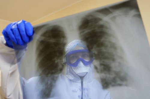 Вирусолог назвал наиболее подверженных тяжелому течению COVID-19 людей