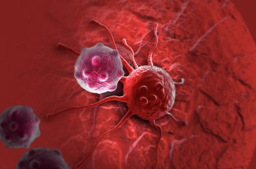 Назван главный способ отличить ложные симптомы рака от настоящих