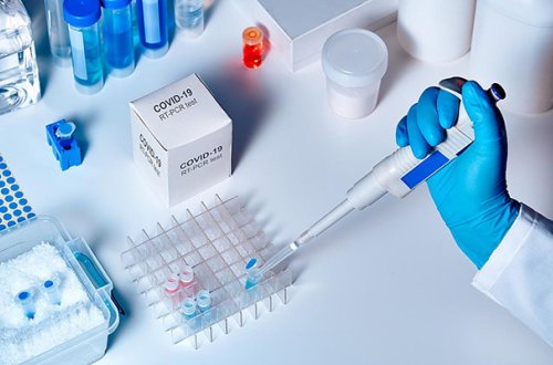 Koronavirusla bağlı bu günə olan statistika