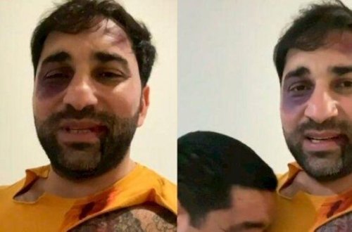 Kamil Zeynallı ermənilərə əsir düşüb?-VİDEO