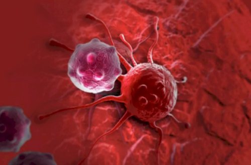 Qidanı xərçəng xəstəliyinə çevirən əsas səhv açıqlandı