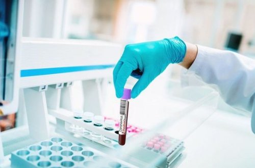 Сотрудница TƏBİB заразилась коронавирусом