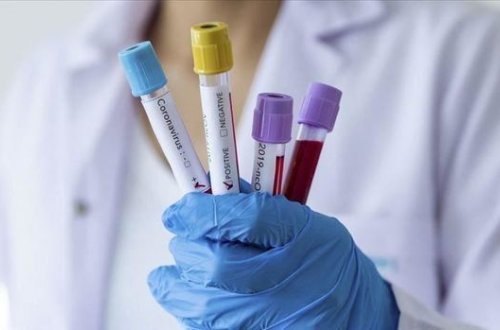 Azərbaycanda son sutkada 3469 nəfər COVID-19-a yoluxub - FOTO