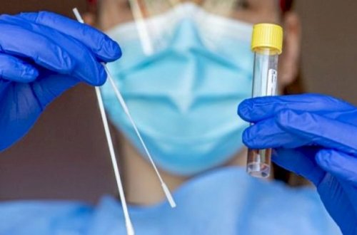 Bu şəxslərdən koronavirus testi götürülməyəcək - RƏSMİ