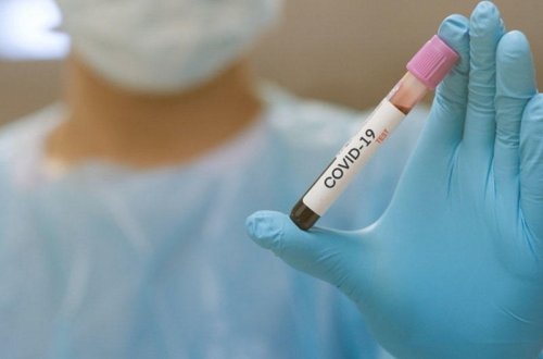 Ermənistanda daha 29 nəfər koronavirusdan öldü