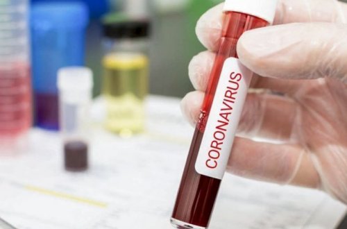 В Азербайджане выявлено еще 3 942 случая заражения коронавирусом