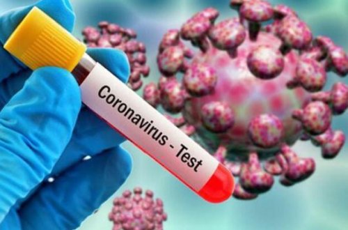 Azərbaycanda 1 ay sonra koronavirusa yoluxma azalacaq - PROFESSOR