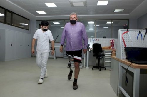 Azərbaycanda hazırlanmış ilk yüksək texnologiyalı protezlər təqdim edildi - FOTO