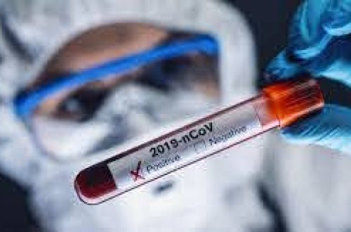 ÜST-dən koronavirus əleyhinə peyvəndlə bağlı AÇIQLAMA