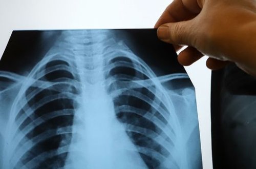 Странное ощущение спасло девушку от рака