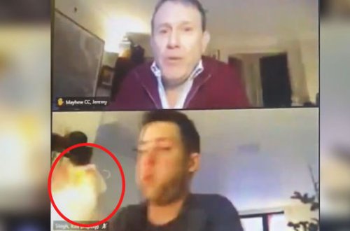Siyasətçi onlayn konfrans zamanı təsadüfən özünü yandırdı - VİDEO