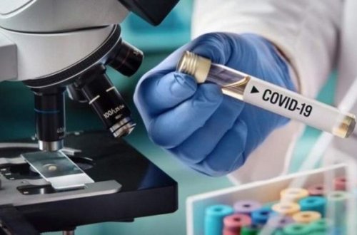 Yaşayış yerlərini tərk edən 55 aktiv COVID-19 xəstəsi müəyyən olundu