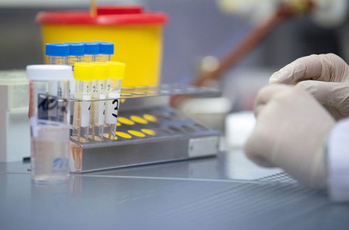 Ханде Харманджи назвала цель визита миссии ВОЗ в Азербайджан