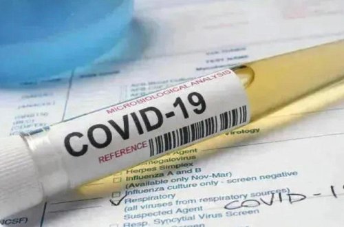 Gürcüstanda son sutkada 3 487 nəfər koronavirusa yoluxub, 39 nəfər ölüb