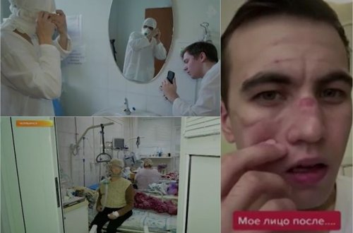 “Qırmızı zona”da işləyən tibb işçisi “TikTok” ulduzuna çevrildi - VİDEO