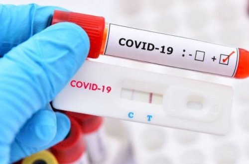 Moskvada bir gündə 73 nəfər koronavirusdan öldü