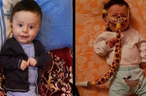 Маленькому Тунару необходима срочная помощь - ФОТО/ВИДЕО