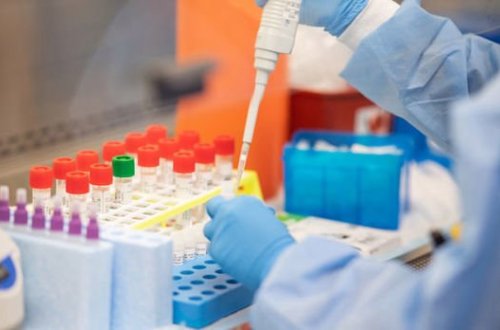 Azərbaycanda daha 40 nəfər koronavirusdan öldü: 1850 yeni yoluxma - FOTO