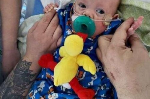 Tibbdə möcüzə: 21-ci həftədə 500 qram doğulan körpə sağ qaldı - FOTO