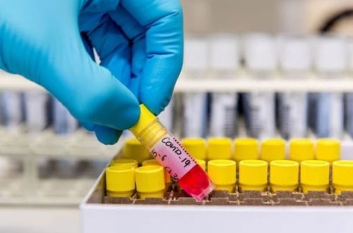 Число инфицированных коронавирусом в мире превысило 81 млн