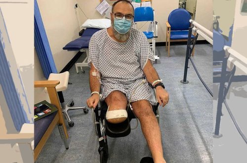 Sağlam kişi koronavirusa yoluxduqdan sonra ayağını itirdi - FOTO