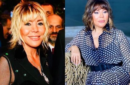 Brilliant Dadaşovanın üzünə nə olub? - FOTO