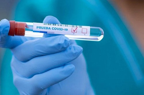 Ölkə üzrə COVID-19-a yoluxma statistikası açıqlandı