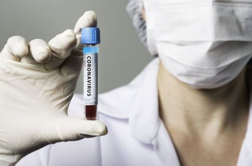 Azərbaycanda daha 31 nəfər koronavirusdan öldü: 802 yeni yoluxma - FOTO