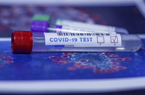 Yoluxanların və ölənlərin sayı azaldı - FOTO