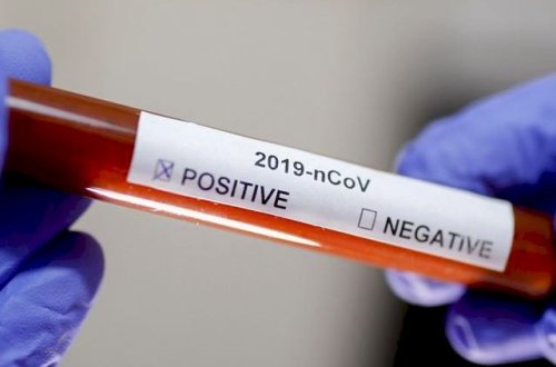 Gürcüstanda son sutkada koronavirusdan 21 nəfər ölüb