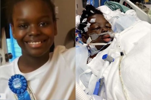 Koronavirusa görə 10 yaşlı oğlanın ayaqları kəsiləcək - FOTO/VİDEO