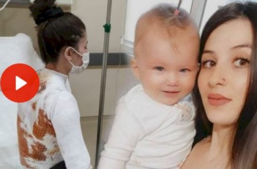 Ailədə dəhşət: Kişi arvadının üzərinə qaynar su tökdü