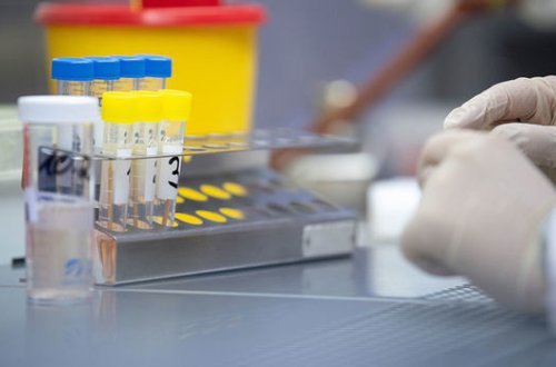 Azərbaycanda daha 15 nəfər koronavirusdan öldü: 402 yeni yoluxma - FOTO