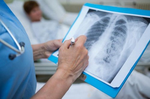 Pnevmoniya ölümlə nəticələnə bilər - Bu şəxslər daha diqqətli olsunlar