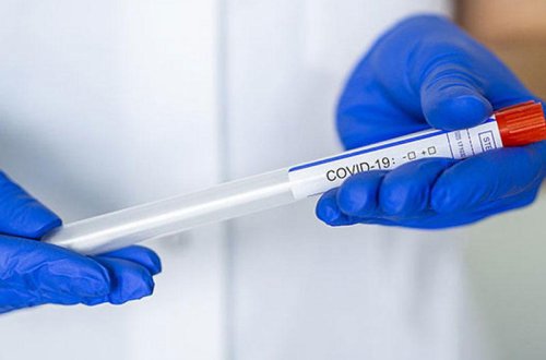 В Азербайджане выявлены 305 новых случаев инфицирования коронавирусом, скончались 10 человек - ФОТО