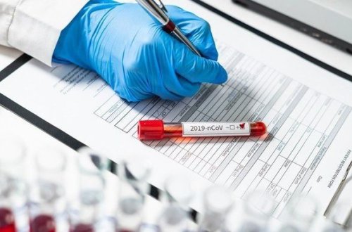 В Азербайджане выявлены 332 новых случая инфицирования коронавирусом, скончались 12 человек - ФОТО