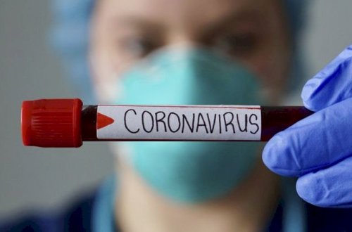 Ermənistanda koronavirusdan ölənlərin sayı 3021-ə çatdı