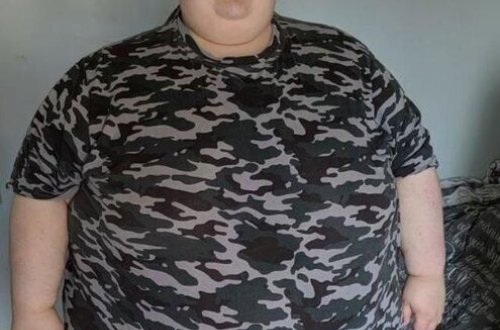 260 kilo çəki ilə cinsiyyətini dəyişmək istədi - Həyatının ŞOKUNU YAŞADI - FOTO